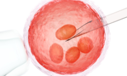 Fertility preservation