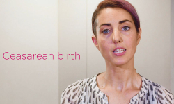 Common variations to spontaneous labour and birth